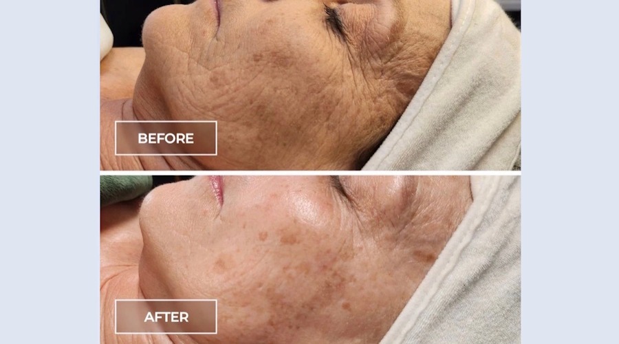 Discover the Circadia SWiCH Treatment